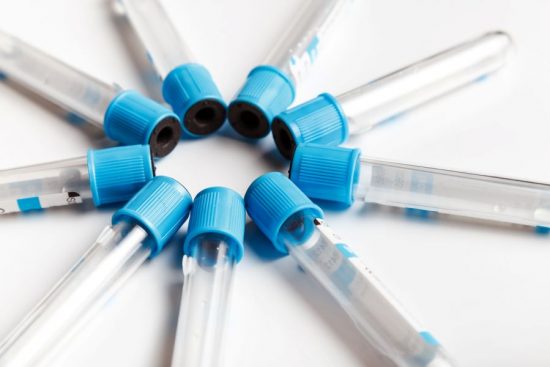 blood-sample-test-tubes-for-blood-test-isolated-on-2022-12-16-21-53-52-utc blood-sample-test-tubes-for-blood-test-isolated-on-2022-12-16-21-53-52-utc